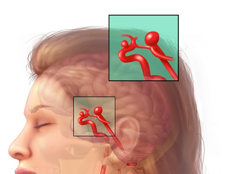 Neurosurgeon Supports Drive Focusing on ‘Stroke Attacks’
